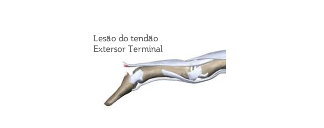 TRAUMACORE - Ortopedia e Traumatologia - Farroupilha / RS